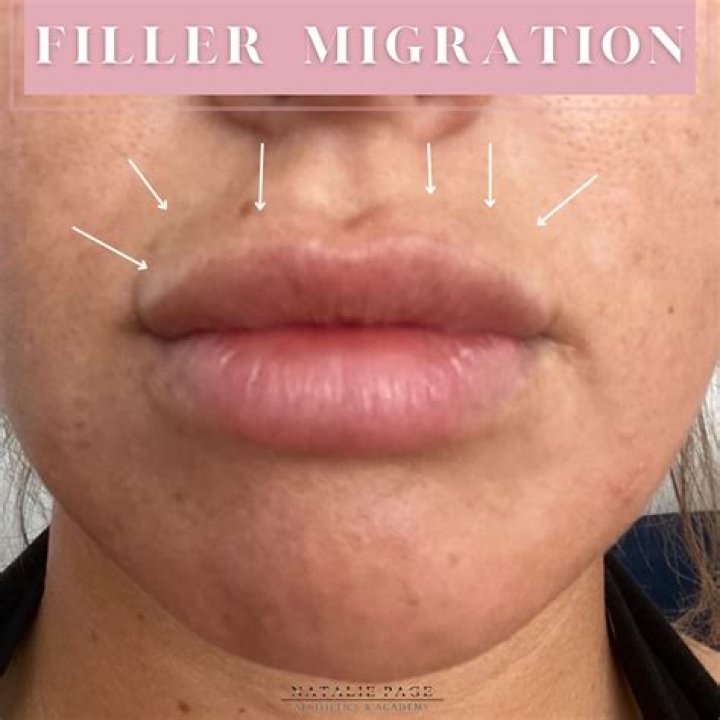 Had RHOSLC Mary Cosby Done Plastic Surgery? Fans Suspect Botox And Lip Filler!