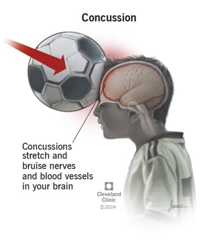 
Seth Jarvis Suffering A Massive Injury – Leaving The Game After Painful Head Concussion 