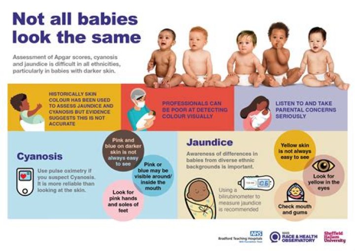 
What Is Parechovirus In Babies? Effects On Newborns And Treatment Methods Explained 
