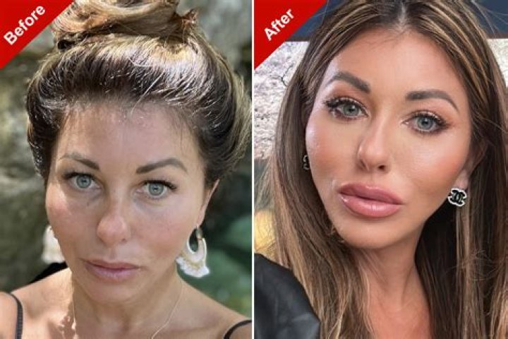 
Yvie Oddly Before And After Plastic Surgery: Here Is What You Need To Know About The Drag Queen 